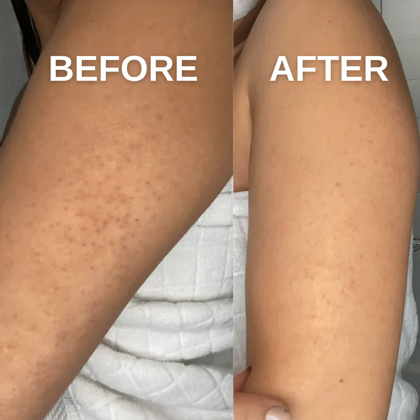 Exfoliërende handschoen